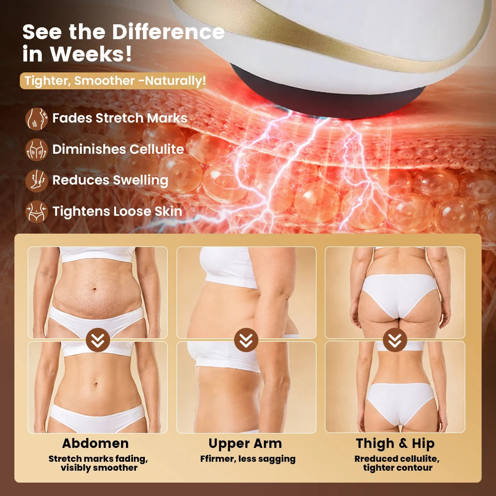 Lumora Skin™ - Anti-Cellulite Body Massager